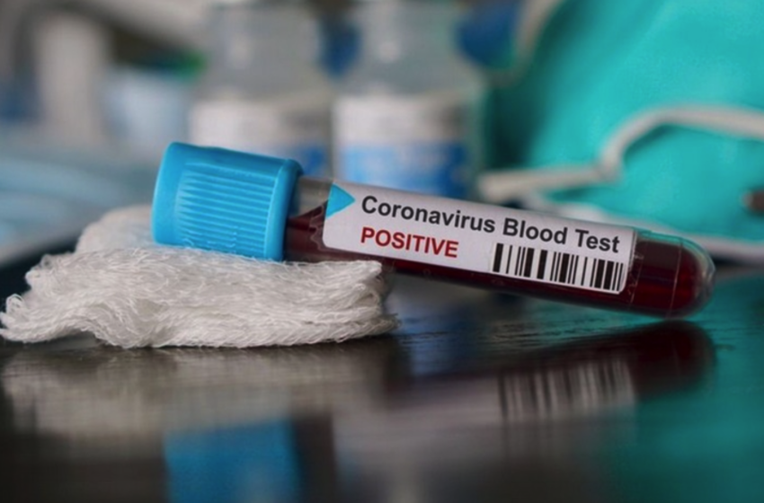  Κύπρος: Ένας νεκρός, 35 νέα περιστατικά