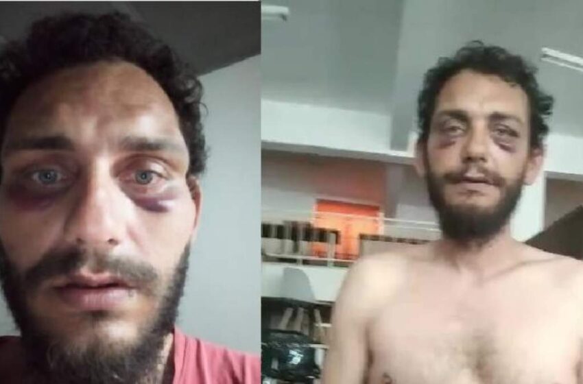  Καταγγελία πολίτη: Ξυλοκοπήθηκε άγρια από αστυνομικούς επειδή… τον πέρασαν για Πακιστανό