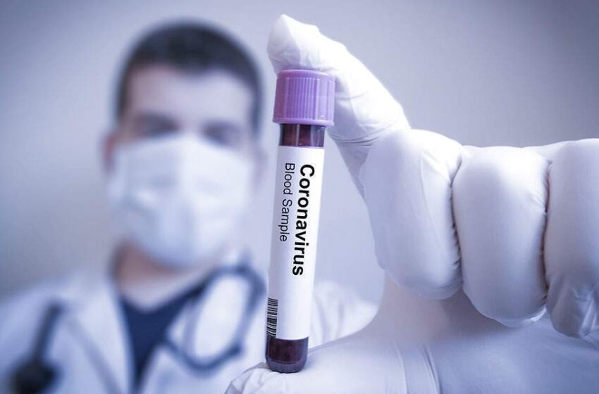  Το αισιόδοξο και το απαισιόδοξο σενάριο για το εμβόλιο του Covid 19