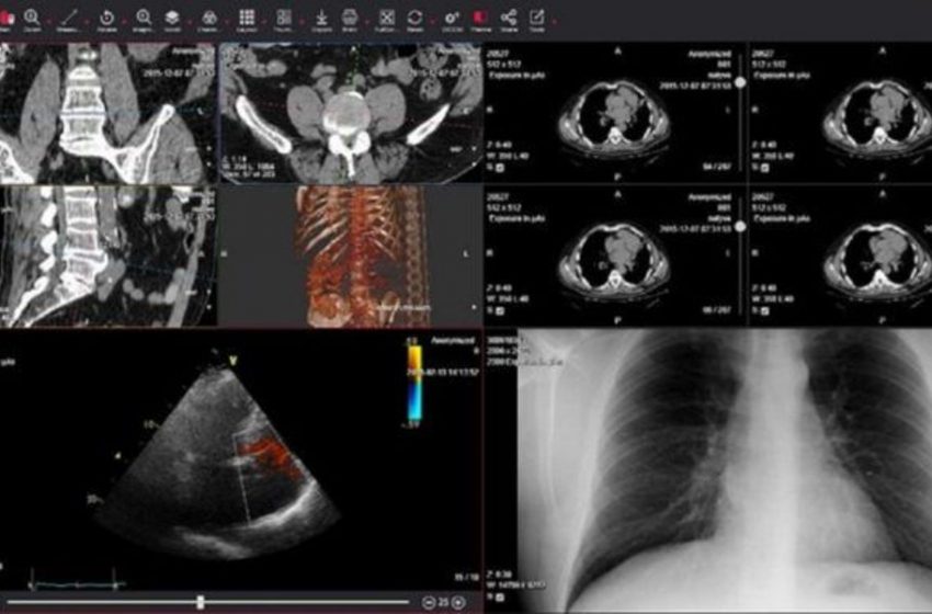  DeepCOVID-XR: Η εξέταση που ανιχνεύει τον κοροναϊό δέκα φορές πιο γρήγορα από τα τεστ