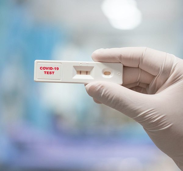  Γιατί το rapid test βγαίνει αρνητικό και το PCR θετικό – Η εξήγηση Μαγιορκίνη