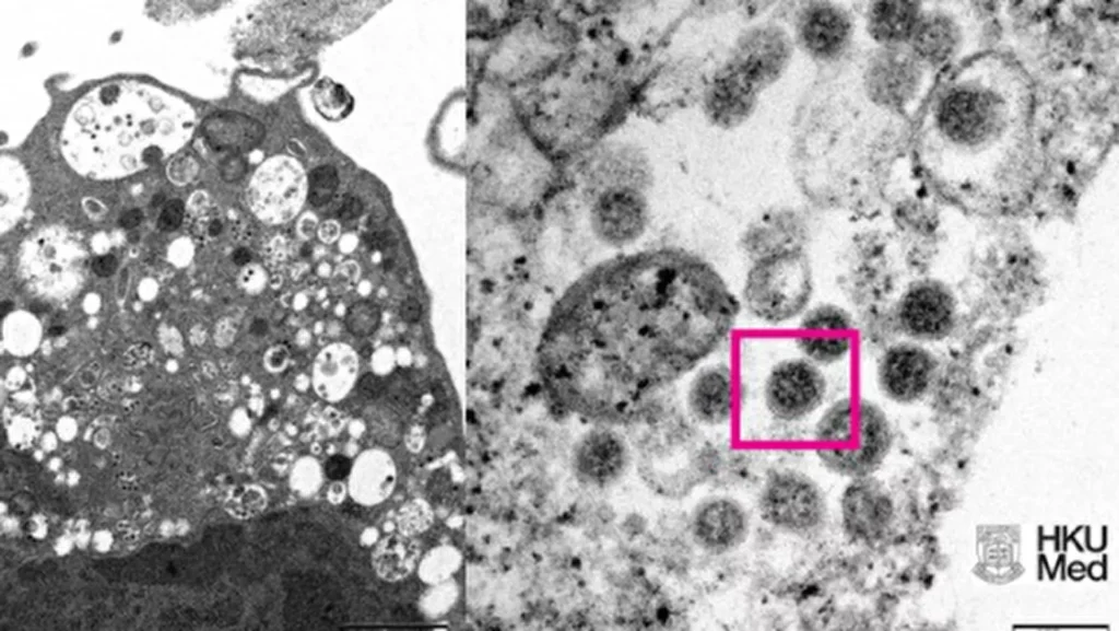 21140916 70 0 548 269 1920x0 80 0 0 d0ec1c8d0f590bf244c8da8f7768b650.png