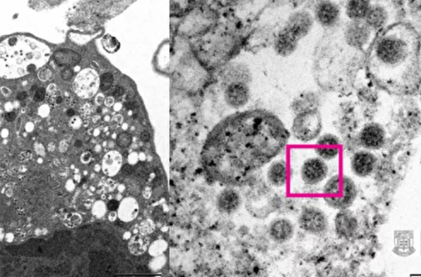 Αυτή είναι η μετάλλαξη Όμικρον – Η πρώτη φωτογραφία από μικροσκόπιο