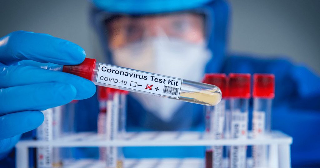 img Vial Test 1200x630 used on 7 24 2020