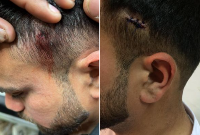  Ταξιτζής κατηγορείται ότι πυροβόλησε μετανάστη στο κεφάλι – Φώναζε “γ@@ω τους Μουσουλμάνους”