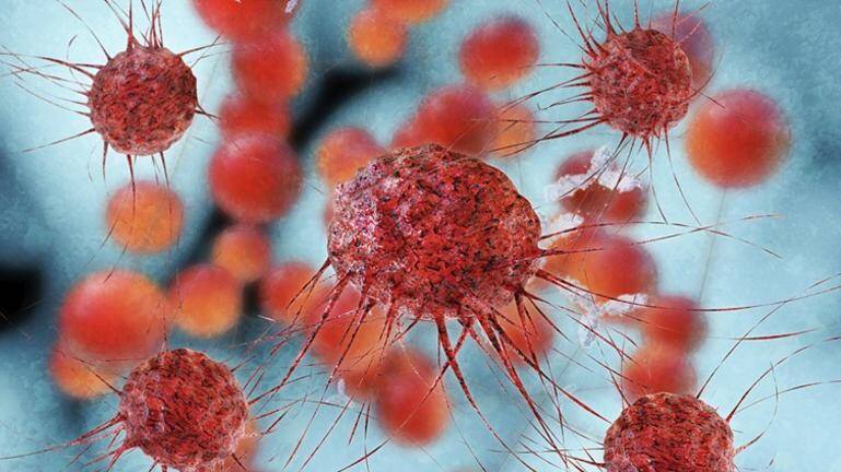  Φόβοι για ευρωπαϊκή επιδημία καρκίνου την επόμενη 10ετία -Τι ανησυχεί τους ειδικούς- Πώς σχετίζεται με τον κοροναϊό