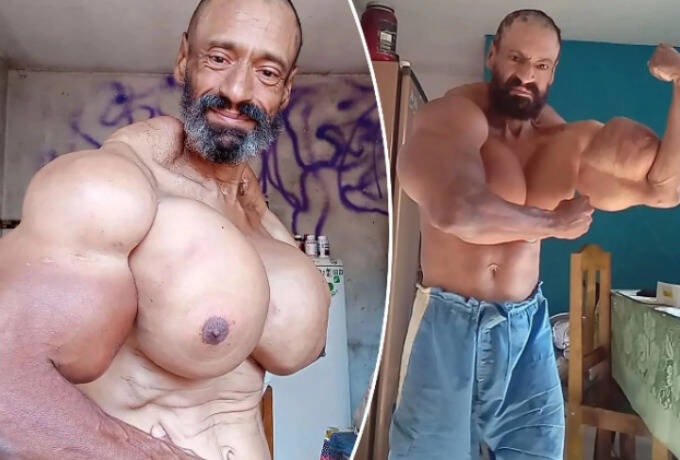  Πέθανε ο Hulk, ο bodybuilder που έκανε ενέσεις με λάδι στους μύες του (vid)