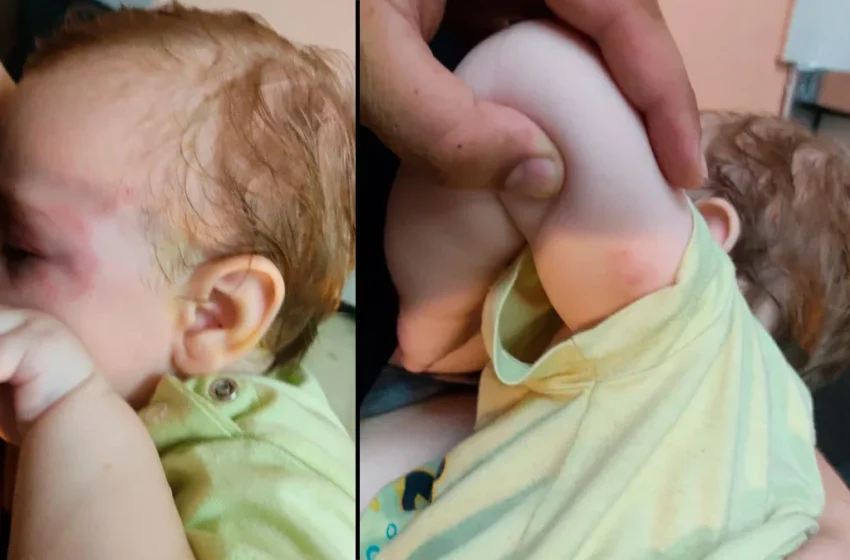  Κρήτη: Συγκλονίζει ο πατέρας του βρέφους που δέχθηκε επίθεση από λυκόσκυλο – “Δάγκωνε με μανία το παιδί μου”