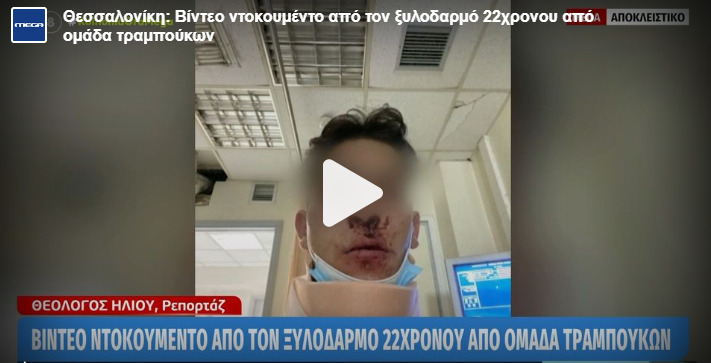  Βίντεο ντοκουμέντο από τον ξυλοδαρμό 22χρονου από τραμπούκους στη Θεσσαλονίκη (vid)