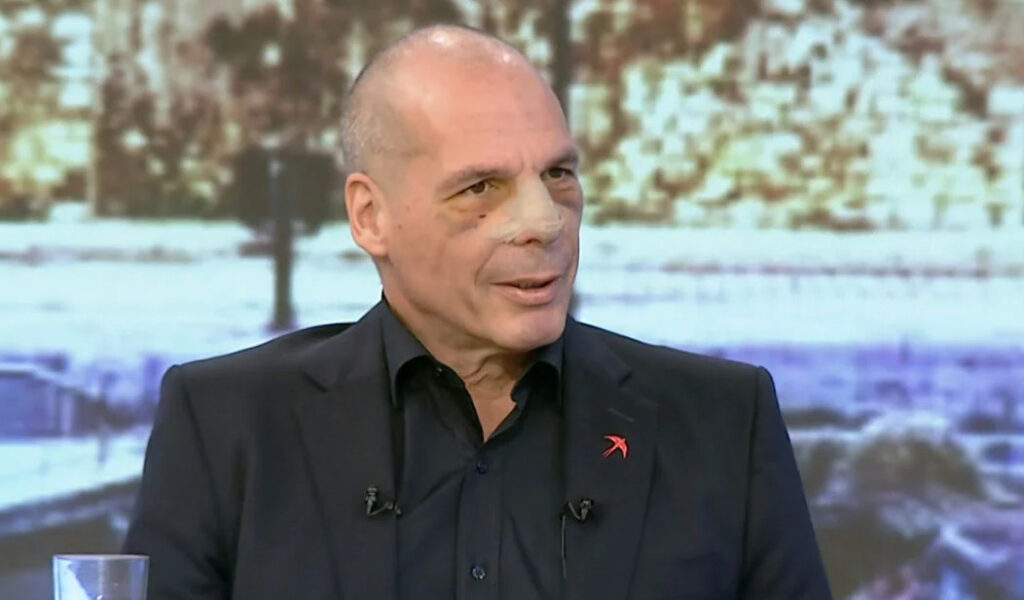 Καταγραφή 3 2