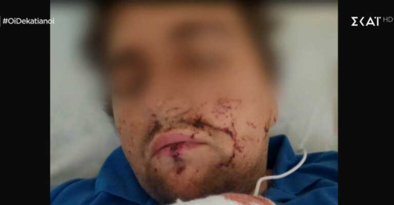  Ουκρανία: Έλληνας στρατιώτης τραυματίστηκε στις συγκρούσεις – Έχει διπλή υπηκόοτητα- Νοσηλεύεται στο νοσοκομείο Κιέβου