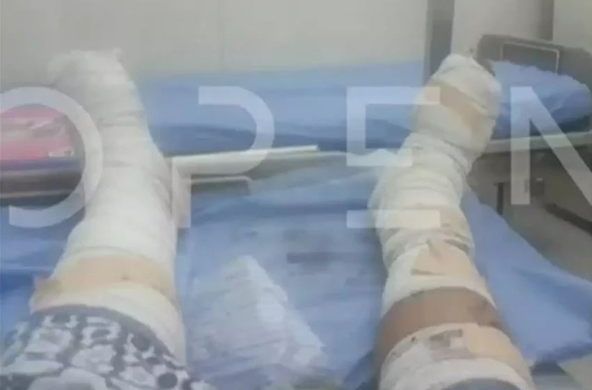  Σουδάν: Φωτογραφία ντοκουμέντο του Έλληνα τραυματία – Αιμορραγεί αλλά οι γιατροί δεν μπορούν να φτάσουν στο νοσοκομείο (vid)