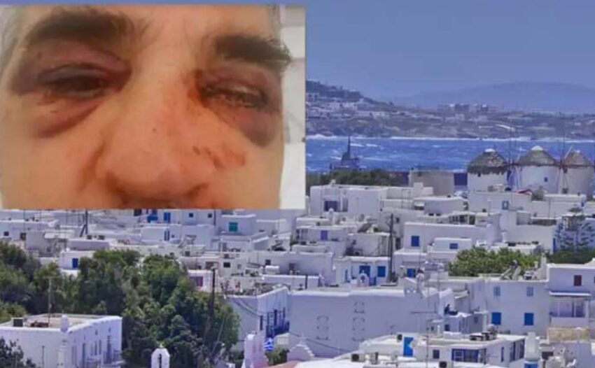  Μύκονος: Έπιασαν ύποπτο για τον ξυλοδαρμό του αρχαιολόγου μετά από καταδίωξη στην Αθήνα