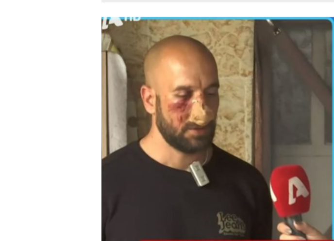  Νέο επεισόδιο οπαδικής βίας: Ξυλοκόπησαν αθλητή της ΑΕΚ – Του έστησαν καρτέρι έξω από το σπίτι του