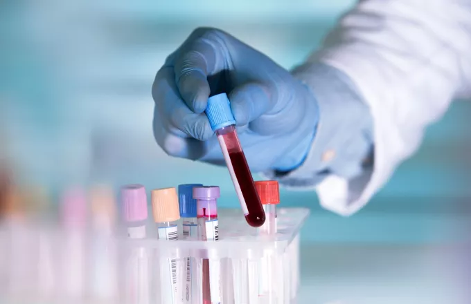  Ιατρική επανάσταση! Πώς το τεστ αίματος Galleri μπορεί να ανιχνεύσει 50 τύπους καρκίνου