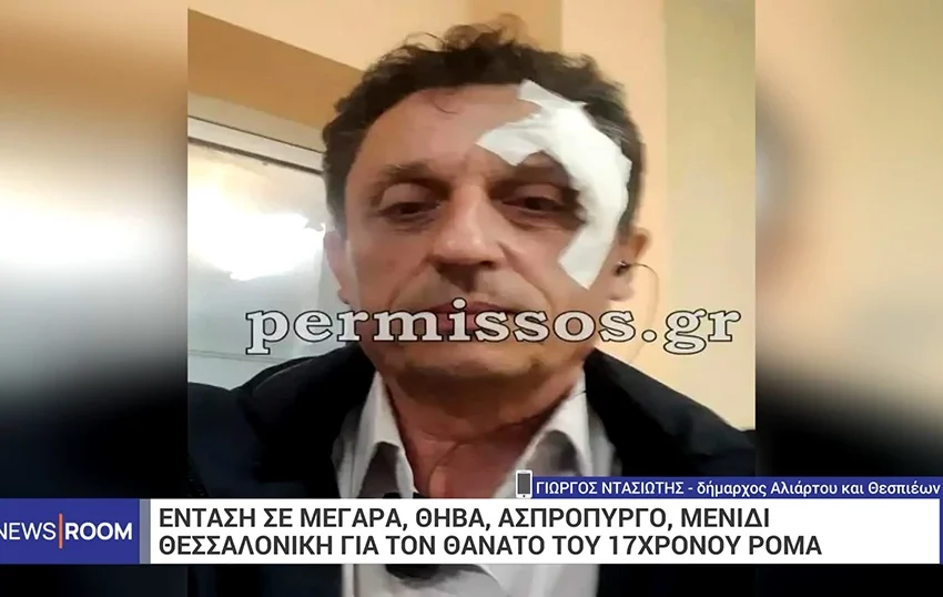  Δήμαρχος Αλιάρτου: “Θα μπορούσα να έχω χάσει το μάτι” – Τι λέει για την επίθεση των Ρομά