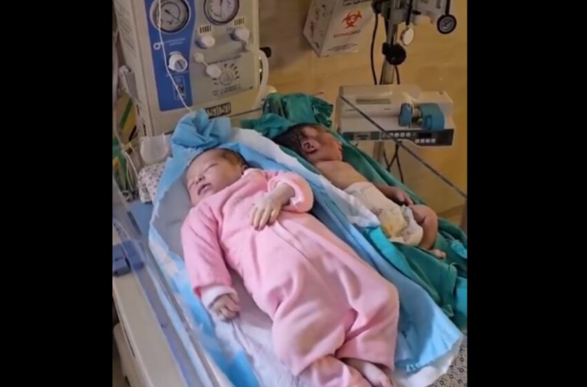  Γάζα:Βρέφη στα νοσοκομεία πεθαίνουν από υποσιτισμό και αφυδάτωση (σκληρά vid)