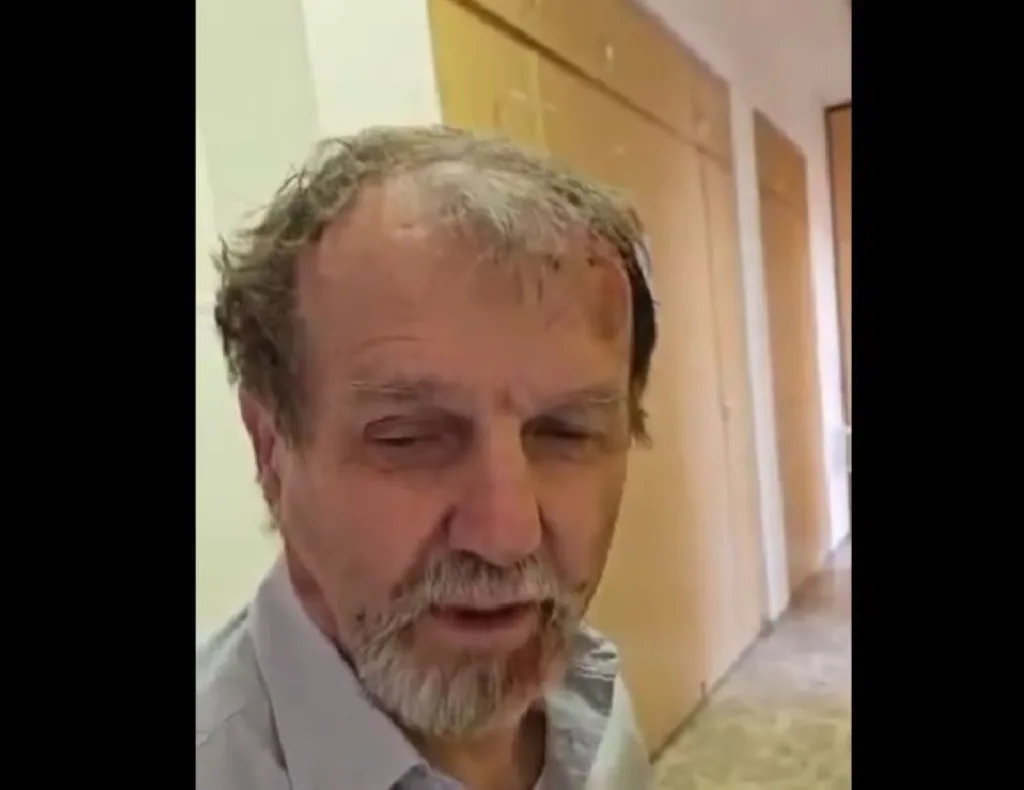 robert fico drastis epithesi video aitia