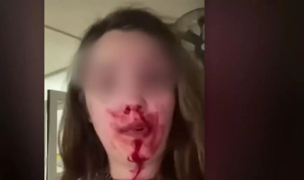 amfissa ksylodarmos 22xroni syzygos video