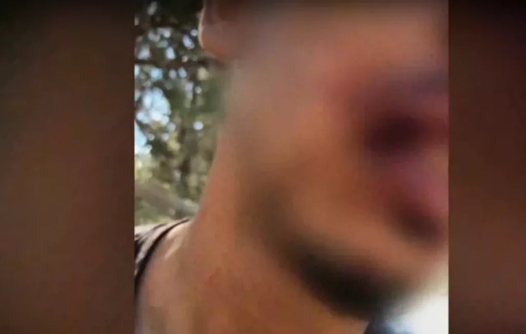 vari ksylodarmos 17xronos