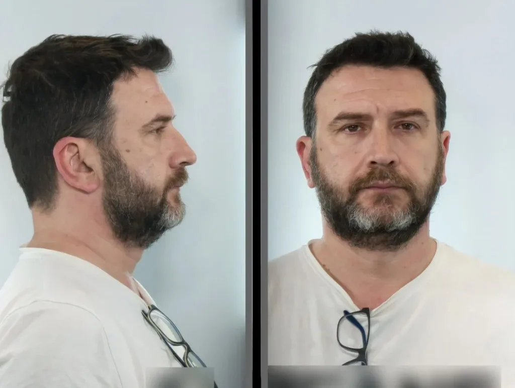 taxi odigos kartes klopes