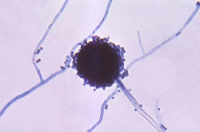  Aspergillus: Συναγερμός για τον μύκητα της κλιματικής αλλαγής-Μπορεί να μας “φάει από μέσα προς τα έξω”