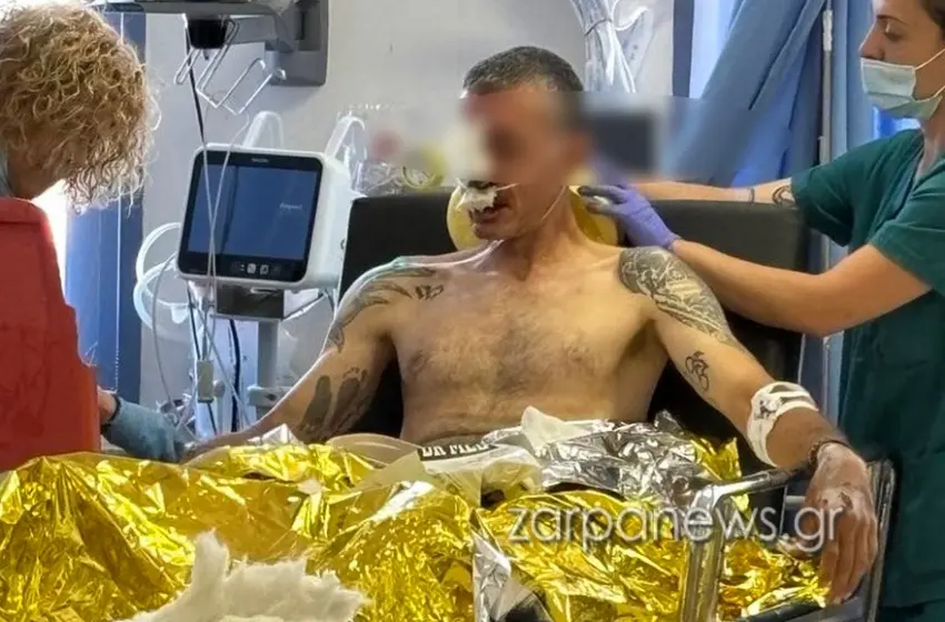  Χανιά: Σοκαριστικός τραυματισμός πρωταθλητή ποδηλασίας- Πώς σώθηκε, θα κάνει χειρουργεία