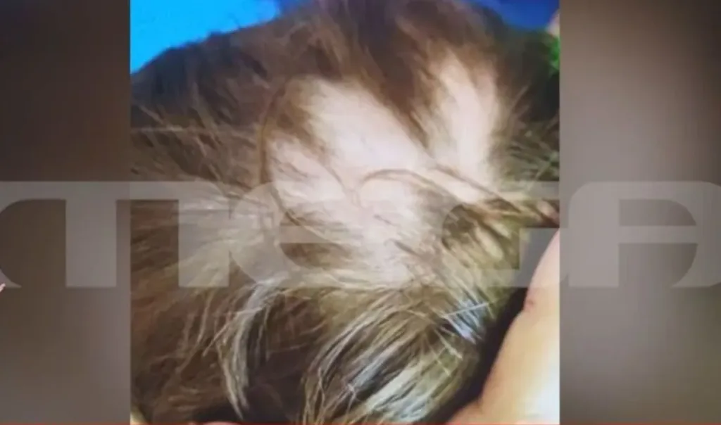 avlonas 2xronos kakopoihsh