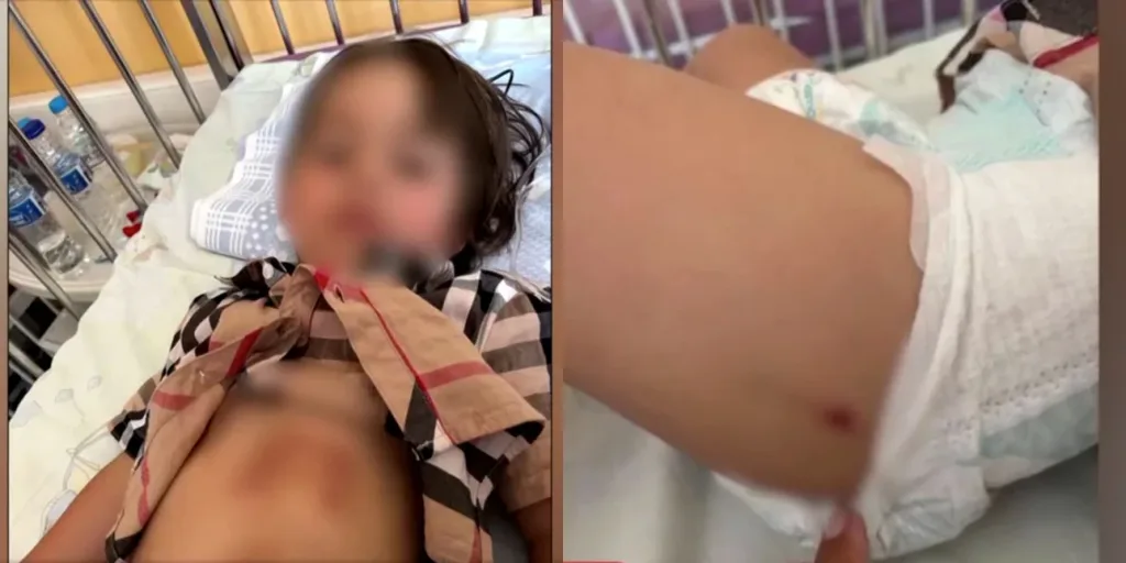 likos epithesi xalkidiki.jpg