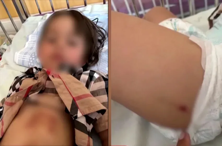 likos epithesi xalkidiki.jpg