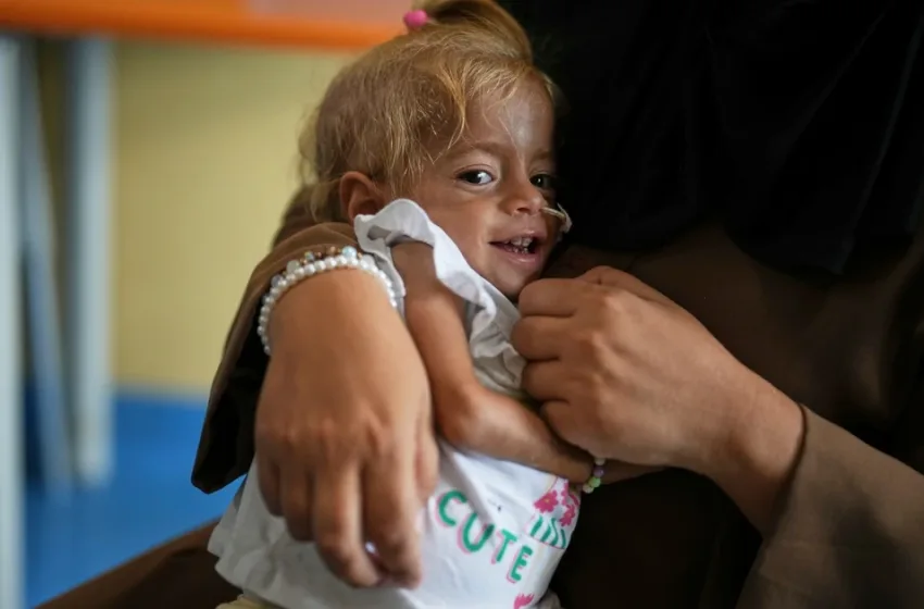  Ιταλία: Κοριτσάκι από τη Γάζα με σπάνια ασθένεια αναρρώνει από υποσιτισμό