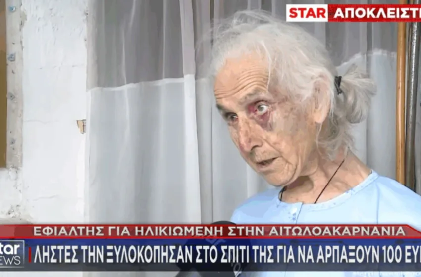  Αγρίνιο: Ληστές ξυλοκόπησαν άγρια 85χρονη – “Μη με χτυπάτε άλλο” φώναζε η ηλικιωμένη