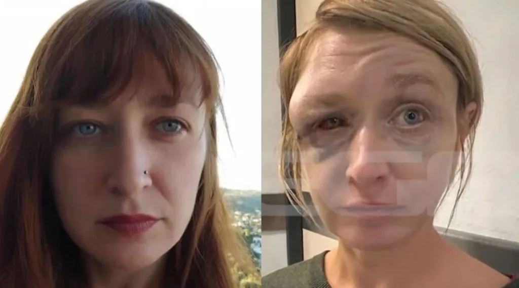 koropi ksylodarmos 40xroni 50xronos