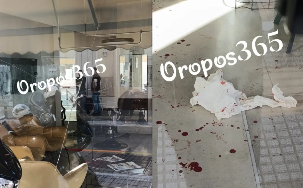 orop epith22 1200x746 1