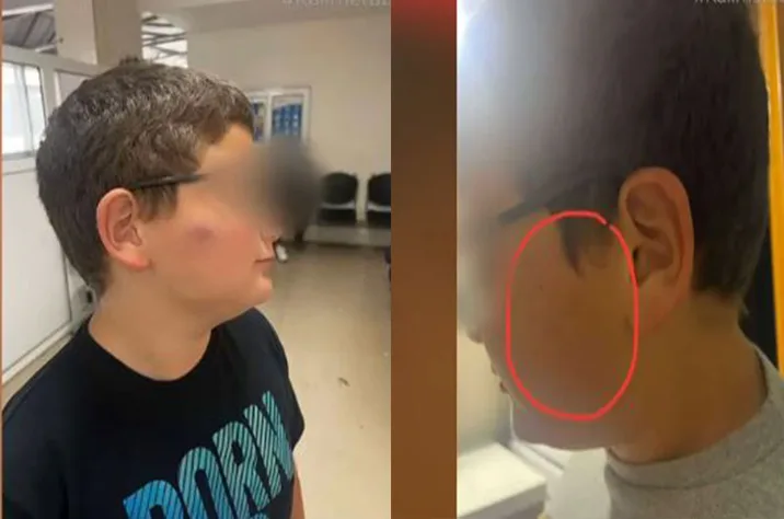  Θεσσαλονίκη: ΕΔΕ για τον ξυλοδαρμό 11χρονου από συμμαθητές του