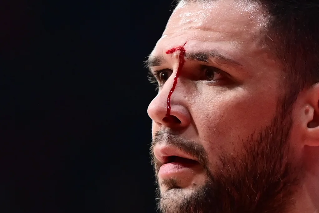 Σοκ στο ΣΕΦ: Ο Παπανικολάου αποχώρησε με αίματα από το παρκέ 2 6787248