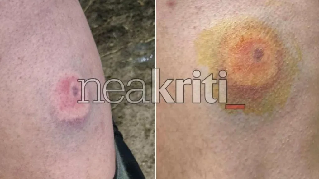 agrotes irakleio astynomia plastikes sfaires