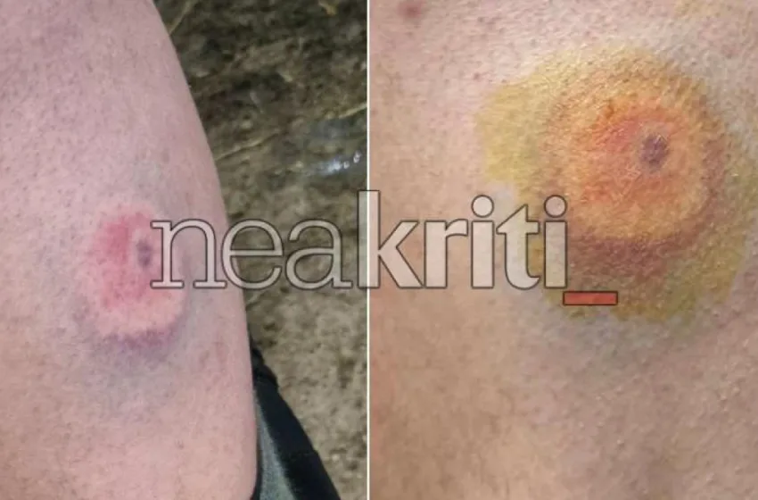 agrotes irakleio astynomia plastikes sfaires