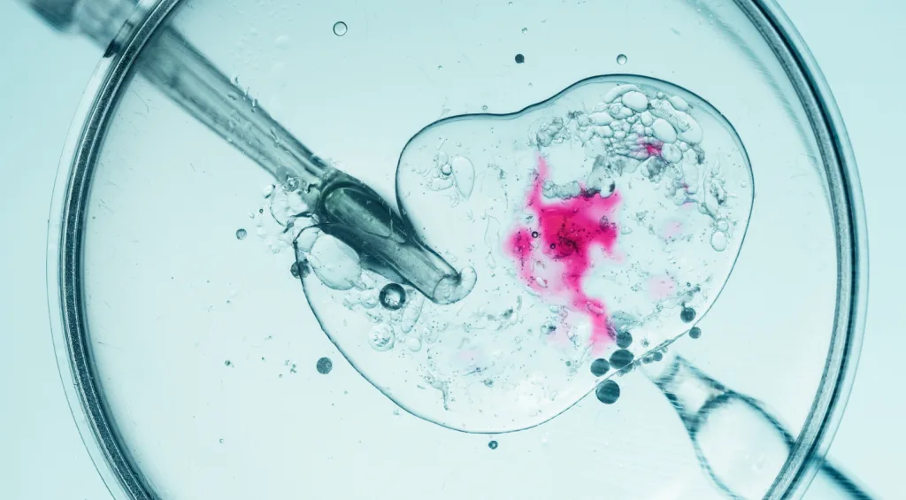 sperma dotis klinikes paidia karkinos