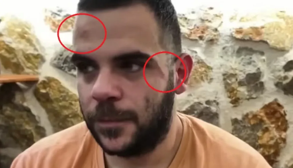 teosty ksylo youtuber epithesi