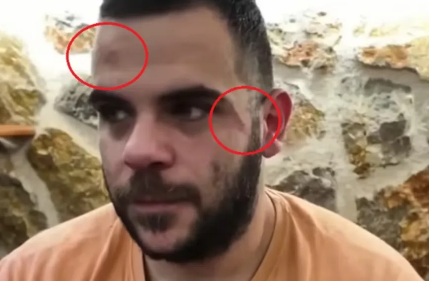 Άγριος ξυλοδαρμός γνωστού Youtuber σε live μετάδοση- Εμφανίστηκε με μελανιές, βίντεο ντοκουμέντο