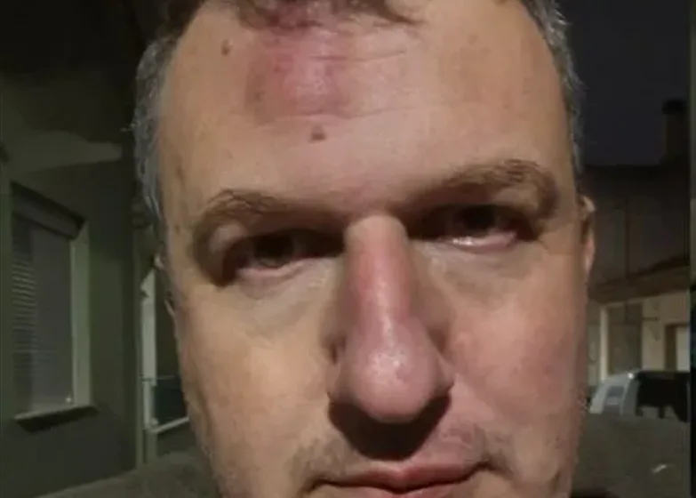  Επίθεση στον δημοσιογράφο και εκδότη της εφημερίδας “ΜΑΓΝΗΣΙΑ” Δημήτρη Καρεκλίδη