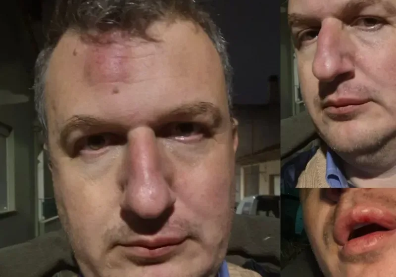  Εκδότης “Μαγνησίας” για τον ξυλοδαρμό του: “Η αστυνομία δεν προέβη ούτε στα αυτονόητα”- Ποιους “δείχνει” ως υπαίτιους