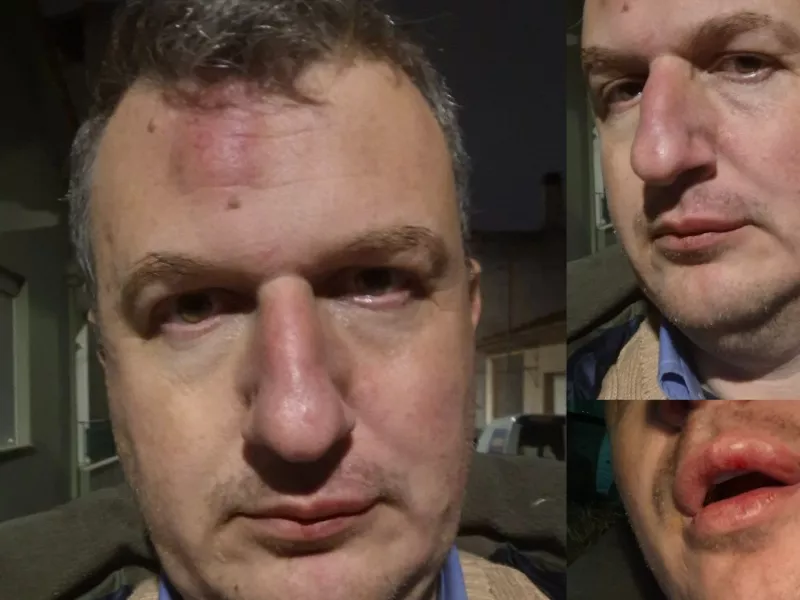 magnisi ksylodarmos epithesi dimosiografos