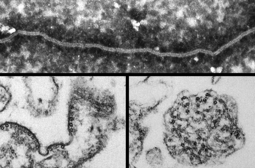  Τι είναι ο Ιός Nipah και γιατί έχει σημάνει συναγερμός στην επιστημονική κοινότητα- Η ανακοίνωση της Κίνας