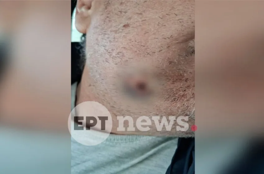  Αιγάλεω: Πως έγινε η άγρια επίθεση στον οδηγό ταξί-“Ένιωσα να τρέχει αίμα από το πηγούνι και την κοιλιά”