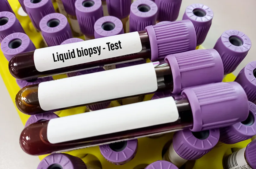  Υγρή Βιοψία: Επαναστατική μέθοδος διάγνωσης καρκίνου μέσα από την έρευνα της Έλενας Θάνου