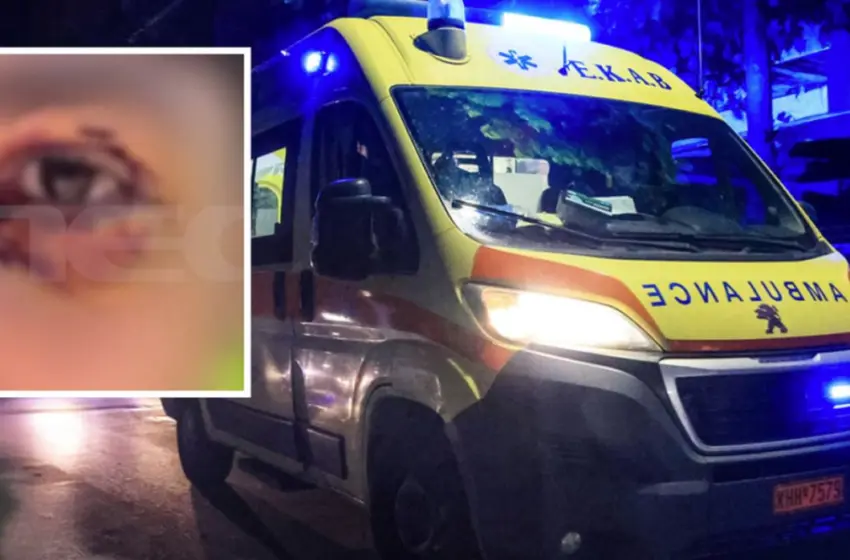  Ιωάννινα: Έστησαν ενέδρα σε 16χρονο, τον ξυλοκόπησαν και κινδύνευσε να χάσει την όρασή του