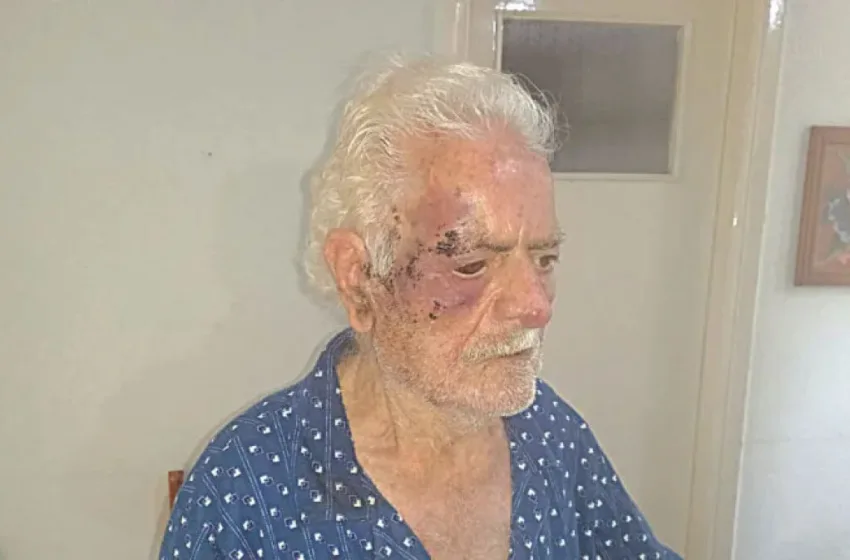  Πάτρα: Άγρια ληστεία με θύματα ηλικιωμένο ζευγάρι που ξυλοξοπήθηκε