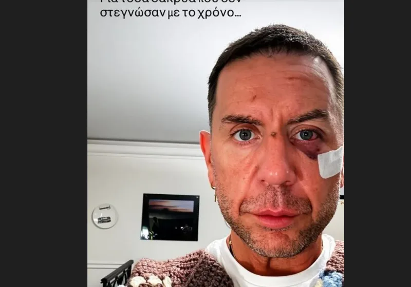 Ανησυχία από την ανάρτηση Μαζωνάκη στην οποία εμφανίζεται με τραύματα